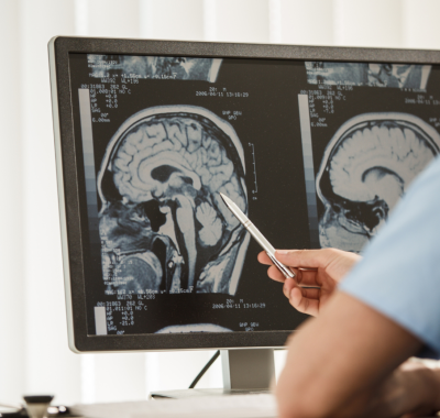 Dr. Rakesh Raghuvanshi Brain Tumor Surgery in Indore Dr. Rakesh Raghuvanshi Brain Tumor Surgery in Indore